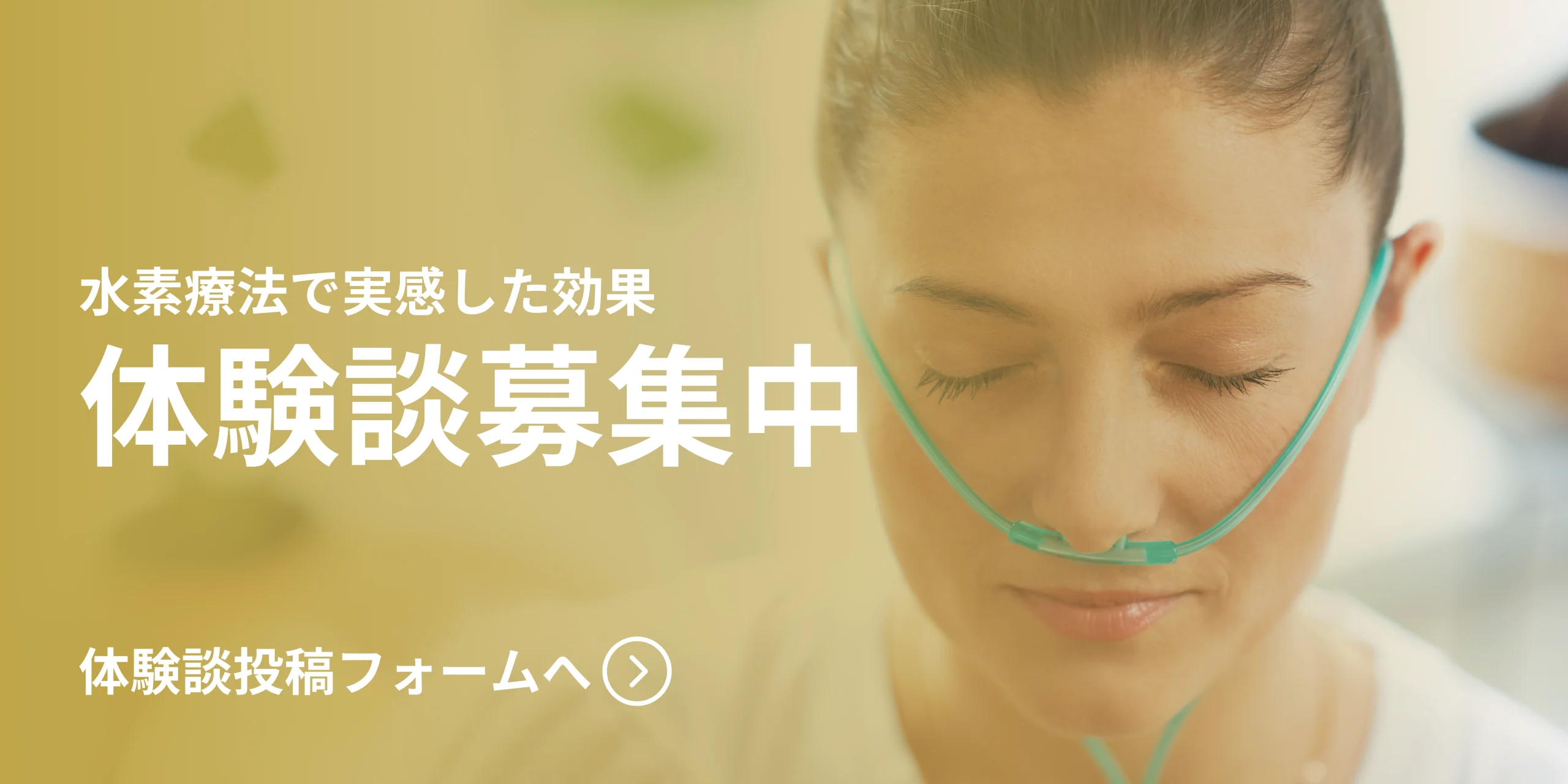 体験談募集バナー