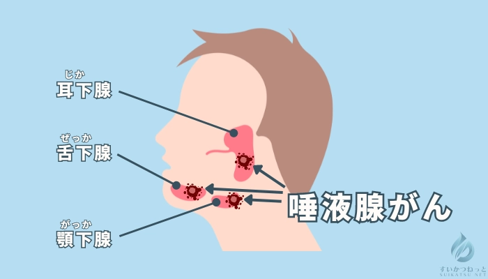 唾液腺がんが発生する位置