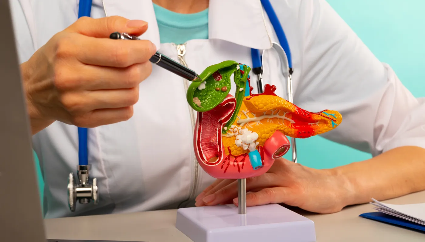 硬化性胆管炎とは？