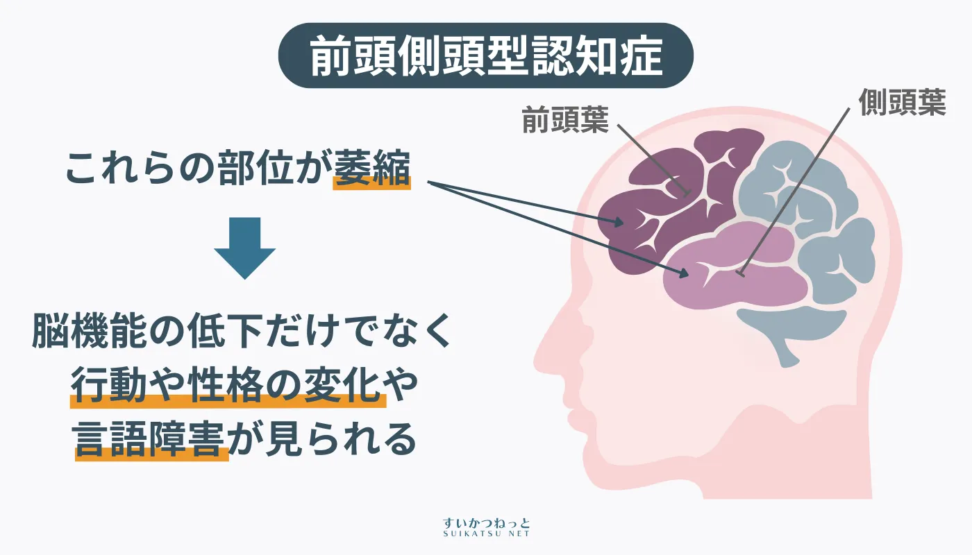 前頭側頭型認知症（FTD）は比較的若年で発症する特徴的な認知症