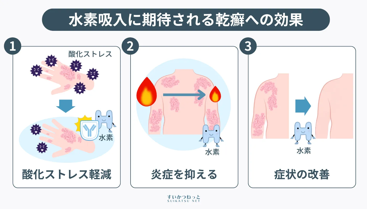 水素吸入は酸化ストレス軽減や炎症を抑えることで乾癬の症状の緩和が期待される