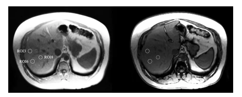 水素水の摂取によって肝臓内の脂肪が減少（Korovljev et al., 2019, Fig.1より引用）