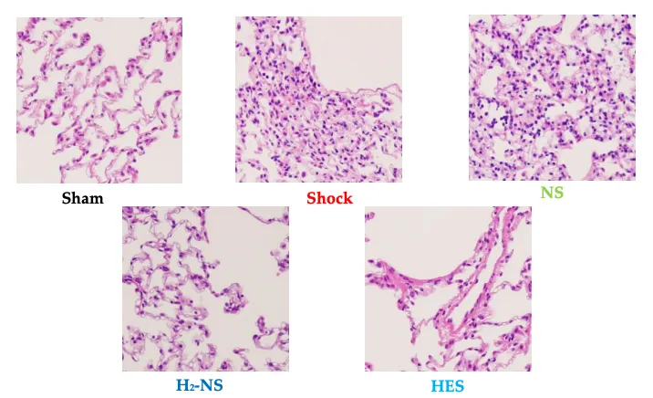 出血性ショック2時間後の肺組織