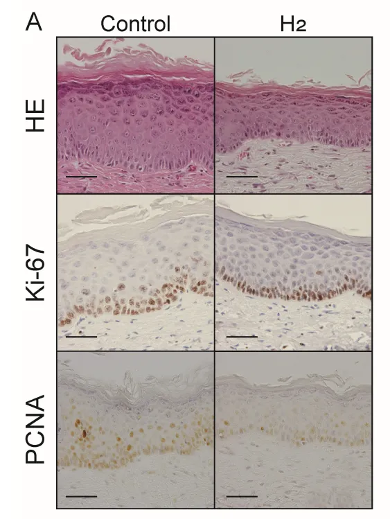 UVB照射後の皮膚断面。水素群では表皮の肥厚が抑えられている（Hori et al., 2026, Fig.7Aより引用）